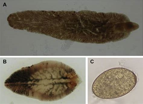  Liver Fluke: A Parasite That Thrives on Bile and Bovine Misfortune!